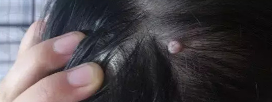 佛说胸前有痣的人【胸前有痣的人前世负过一个人佛教】