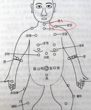 前胸痣图解图片