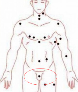 耳轮上长痣代表什么女【女的耳轮有痣】