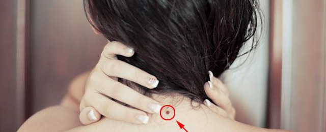 耳轮上长痣代表什么女【女的耳轮有痣】