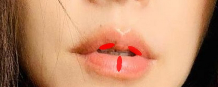 二十种嘴型图解名称【二十种嘴型图解明星】