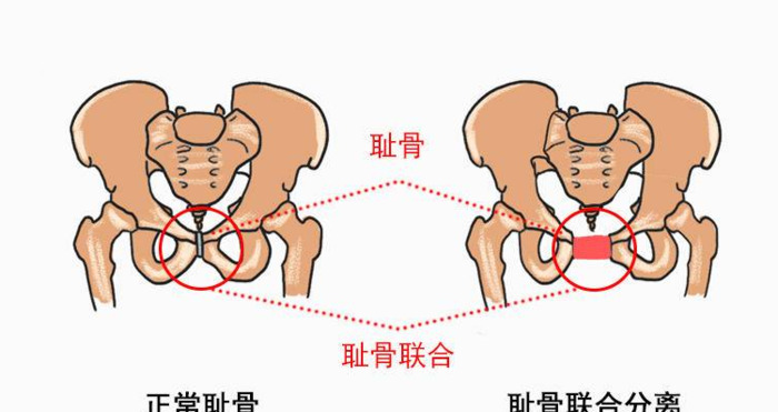 耻骨联合位置图【兔子耻骨联合位置图】