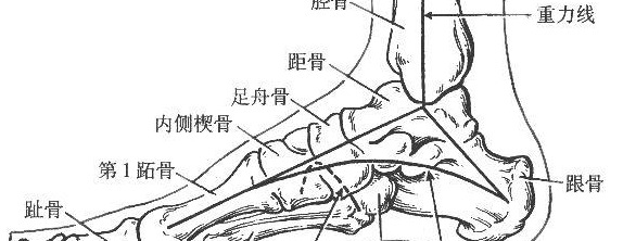 什么是扁平足？【造成扁平足的原因有哪些/】